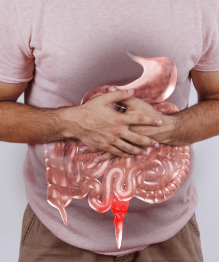 dr-alberto-garnica-cirugia.general-gastrointestinal-5.png